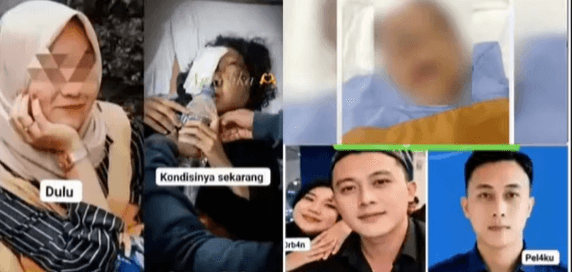 Tak Hanya Disiksa, Yuvita Ternyata Dipaksa Bikin Tato Nama dan Wajah Taufik Hidayat di Beberapa Bagian Tubuh