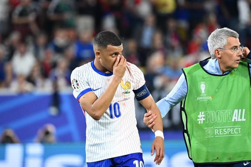 Mbappe Cedera Patah Hidung saat Pertandingan Melawan Austria di Euro 2024 Tadi Malam, Butuh Operasi dan Bakal Absen Berapa Lama Nih?