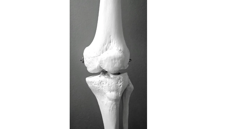 7 Makanan Terbaik untuk Osteoporosis Menurut Ahli, Bisa Untuk Memperkuat Tulang Agar Tidak Mudah Patah