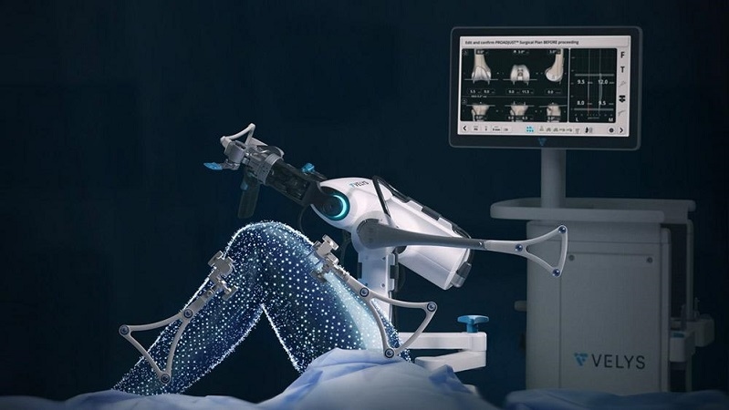 Keren! Operasi Implan Lutut Menggunakan Robot RS Medistra Berjalan Sukses, Jadi yang Pertama di Indonesia