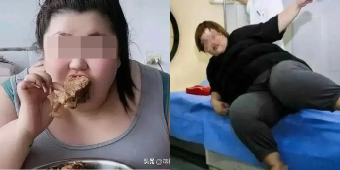 Berat Badannya Naik hingga 300 Kg, Gadis 24 Tahun Meninggal Dunia saat Sedang Live Mukbang: Penyebab Kematiannya karena Makan Berlebihan