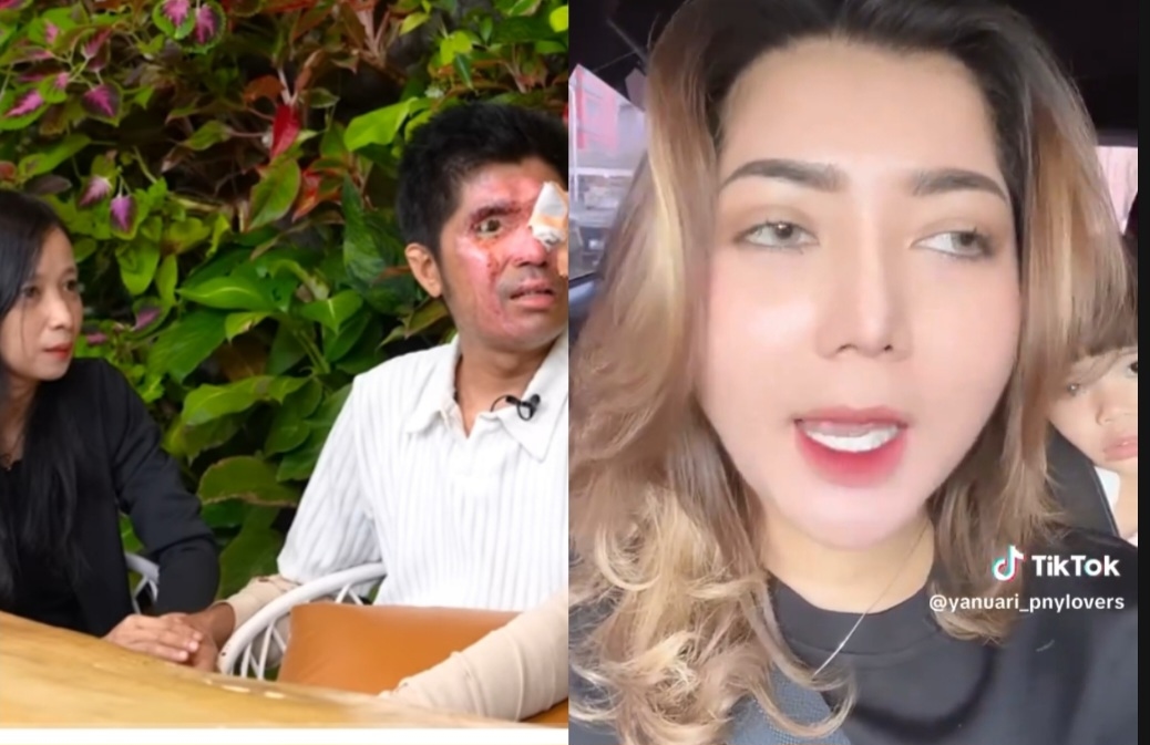 Pratiwi Noviyanthi Sentil Istri Agus Salim yang Cuma Pakai Uang Donasi Rp900 Ribu Dari Total 1,5 M Untuk Berobat